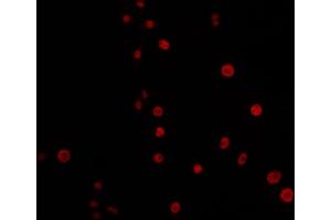 Immunofluorescence (fixed cells) (IF/ICC) image for anti-Excision Repair Cross-Complementing Rodent Repair Deficiency, Complementation Group 4 (ERCC4) (C-Term) antibody (ABIN6266064)