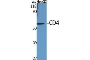 Western Blot (WB) analysis of specific cells using CD4 Polyclonal Antibody. (CD4 抗体  (Ser213))