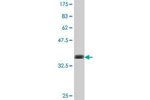 Western Blot detection against Immunogen (37. (PKC epsilon 抗体  (AA 301-400))