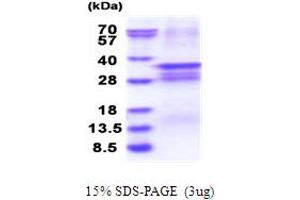 SDS-PAGE (SDS) image for Odd-Skipped Related 2 (OSR2) (AA 1-276) protein (His tag) (ABIN5853854) (OSR2 Protein (AA 1-276) (His tag))