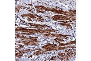 Immunohistochemical staining of human smooth muscle with ARL6IP1 polyclonal antibody ( Cat # PAB28311 ) shows strong cytoplasmic positivity in smooth muscle cells. (ARL6IP1 抗体)