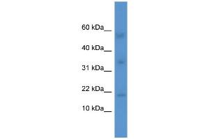 Western Blotting (WB) image for anti-Interleukin 1 Family, Member 10 (Theta) (IL1F10) (Middle Region) antibody (ABIN2788385) (IL1F10 抗体  (Middle Region))