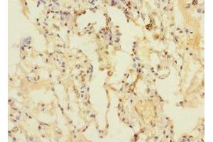 Immunohistochemistry of paraffin-embedded human lung tissue using ABIN7150754 at dilution of 1:100 (DUSP16 抗体  (AA 416-665))