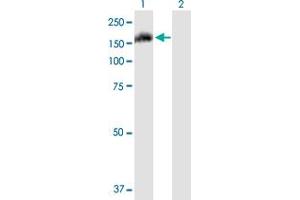 Western Blot analysis of FAM62A expression in transfected 293T cell line by FAM62A MaxPab polyclonal antibody. (ESYT1 抗体  (AA 1-1104))
