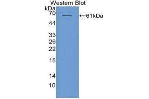 Detection of Recombinant CYP26B1, Human using Polyclonal Antibody to Cytochrome P450 26B1 (CYP26B1) (CYP26B1 抗体  (AA 1-512))