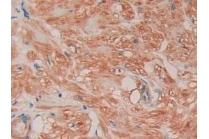 Detection of FLNC in Human Prostate Tissue using Polyclonal Antibody to Filamin C Gamma (FLNC) (FLNC 抗体  (AA 17-259))