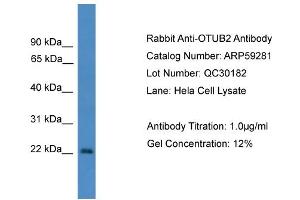 WB Suggested Anti-OTUB2  Antibody Titration: 0. (OTUB2 抗体  (N-Term))