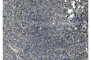 IHC analysis of FLI1 using anti-FLI1 antibody (ABIN7599409). (FLI1 抗体  (AA 1-452))