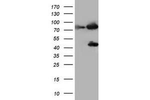 Image no. 1 for anti-Coagulation Factor XIII, A1 Polypeptide (F13A1) antibody (ABIN1498155) (F13A1 抗体)