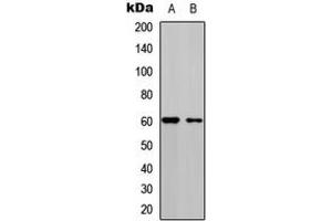 Western blot analysis of CDC25C (pS216) expression in HEK293T (A), A549 (B) whole cell lysates. (CDC25C 抗体  (pSer216))