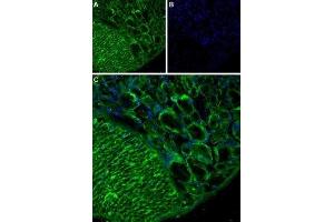 Immunohistochemistry (IHC) image for anti-Transient Receptor Potential Cation Channel, Subfamily A, Member 1 (TRPA1) (AA 747-760), (Extracellular) antibody (ABIN7043813)