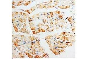 Immunohistochemical analysis of paraffin embedded rat skeletal muscle sections, staining PMVK in cytoplasm, DAB chromeric reaction (PMVK 抗体  (Middle Region))