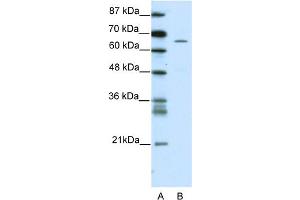 WB Suggested Anti-ZNF205 Antibody Titration:  5. (ZNF205 抗体  (N-Term))