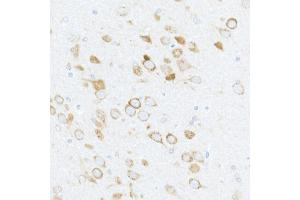Immunohistochemistry of paraffin-embedded rat brain using Phospho-S6 Ribosomal Protein (RPS6)-S240/244 Rabbit pAb (ABIN6135311, ABIN6136242, ABIN6136243 and ABIN6225563) at dilution of 1:50 (40x lens). (RPS6 抗体  (pSer240, pSer244))