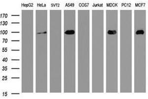 Image no. 1 for anti-Cadherin 1, Type 1, E-Cadherin (Epithelial) (CDH1) antibody (ABIN1497942) (E-cadherin 抗体)