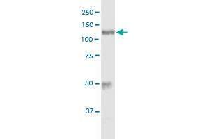 Immunoprecipitation (IP) image for anti-Hexokinase 1 (HK1) (AA 1-916) antibody (ABIN947970)