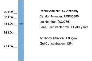 WB Suggested Anti-NPTX2  Antibody Titration: 0. (NPTX2 抗体  (N-Term))