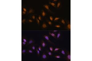 Immunofluorescence analysis of U-2 OS cells using RBM39 antibody (ABIN7270085) at dilution of 1:100. (RBM39 抗体  (C-Term))