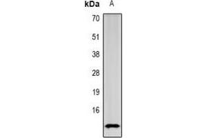 Western Blotting (WB) image for anti-serine Peptidase Inhibitor, Kazal Type 1 (SPINK1) antibody (ABIN7308366)