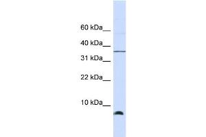 WB Suggested Anti-HSPE1 Antibody Titration: 0. (HSPE1 抗体  (Middle Region))