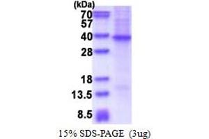 SFRP2 Protein (AA 20-295) (His tag)
