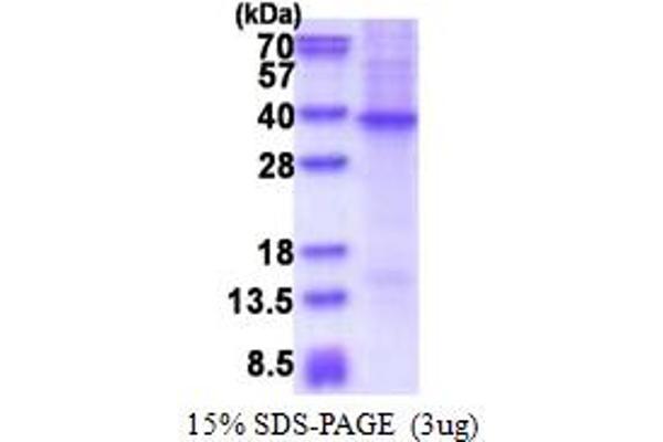 SFRP2 Protein (AA 20-295) (His tag)