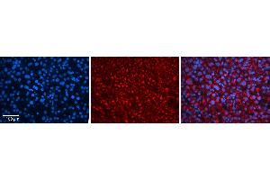 Rabbit Anti-ZNF259 Antibody   Formalin Fixed Paraffin Embedded Tissue: Human Liver Tissue Observed Staining: Cytoplasm in hepatocytes Primary Antibody Concentration: N/A Other Working Concentrations: 1:600 Secondary Antibody: Donkey anti-Rabbit-Cy3 Secondary Antibody Concentration: 1:200 Magnification: 20X Exposure Time: 0. (ZNF259 抗体  (N-Term))