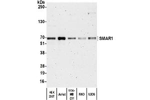 Western Blotting (WB) image for anti-Protein BANP (BANP) (C-Term) antibody (ABIN7453906) (BANP 抗体  (C-Term))