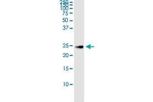 CNTF (Human) IP-WB Antibody Pair