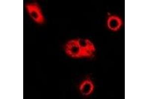 Immunofluorescent analysis of ADSL staining in Hela cells. (Adenylosuccinate Lyase 抗体)