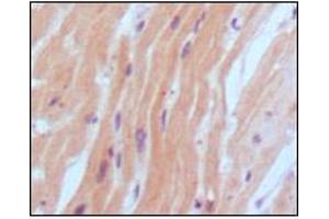Immunohistochemical analysis of paraffin-embedded human normal myocardium, showing cytoplasmic localization using BNP2 mouse mAb with DAB staining. (BNP 抗体)