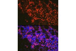 Immunofluorescence analysis of mouse bone marrow cells using FADD Rabbit pAb (ABIN7267137) at dilution of 1:100 (40x lens). (FADD 抗体)