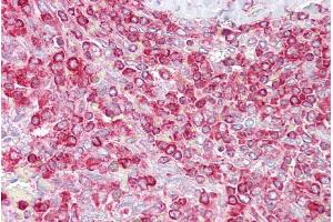 Immunohistochemistry with Spleen tissue at an antibody concentration of 5µg/ml using anti-GCLC antibody (ARP54577_P050) (GCLC 抗体  (Middle Region))