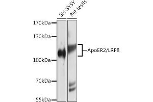Western blot analysis of extracts of various cell lines, using ApoER2/ApoER2/LRP8 antibody (ABIN6134224, ABIN6143337, ABIN6143338 and ABIN6214801) at 1:1000 dilution. (LRP8 抗体  (C-Term))