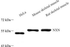 Western blot analysis of NXN (ABIN7074916),at dilution of 1: 1000 (NXN 抗体)