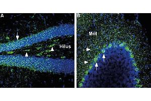 Immunohistochemistry (IHC) image for anti-Solute Carrier Family 2 (Facilitated Glucose Transporter), Member 3 (SLC2A3) (AA 39-52), (Extracellular) antibody (ABIN7043696)