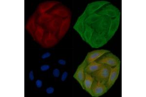 ABIN6257703 and ABIN6273923 staining Hela cells(30 min of UV treatment) by IF/ICC.