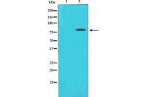 Western Blotting (WB) image for anti-Protein Kinase C, delta (PKCd) (pTyr313) antibody (ABIN6255881)