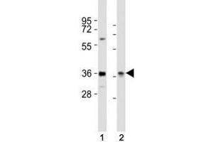 Western Blotting (WB) image for anti-Paired Box 4 (PAX4) (AA 171-200) antibody (ABIN3032125)