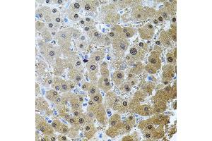 Immunohistochemistry of paraffin-embedded human liver injury using RNF166 antibody (ABIN5974659) (40x lens). (RNF166 抗体)