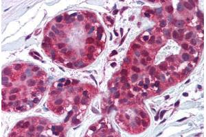 Human Breast (formalin-fixed, paraffin-embedded) stained with TIMP2 antibody ABIN214221 at 10 µg/ml followed by biotinylated anti-mouse IgG secondary antibody ABIN481714, alkaline phosphatase-streptavidin and chromogen. (TIMP2 抗体)