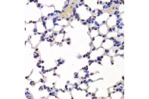 Immunohistochemistry of paraffin-embedded mouse lung using INTS6 Antibody. (INTS6 抗体  (AA 1-280))