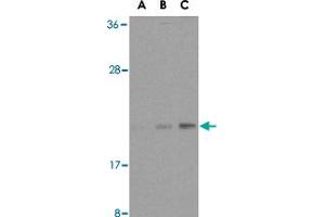 Western blot analysis of BAX in HL-60 cell lysates with BAX polyclonal antibody  at (A) 1, (B) 2, and (C) 4 ug/mL . (BAX 抗体  (N-Term))