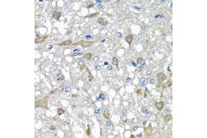 Immunohistochemistry of paraffin-embedded rat brain using C1GALT1C1 antibody at dilution of 1:100 (x40 lens). (C1GALT1C1 抗体)