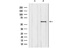 Western blot analysis of lysates from F10, using ETV5 antibody.