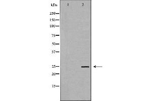 Western blot analysis of Hela whole cell lysates, using TK1 Antibody. (TK1 抗体  (N-Term))