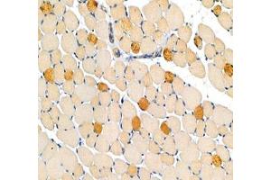 Immunohistochemistry analysis of paraffin-embedded mouse legmuscle using MYH7 (ABIN7075623) at dilution of 1: 100