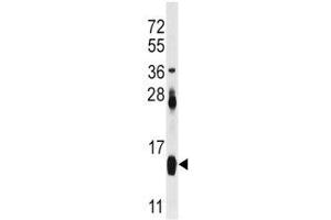 Western Blotting (WB) image for anti-Fatty Acid Binding Protein 4, Adipocyte (FABP4) (AA 1-30) antibody (ABIN3028652)