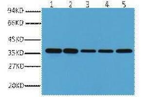 Western Blotting (WB) image for anti-Glyceraldehyde-3-Phosphate Dehydrogenase (GAPDH) antibody (ABIN3187999) (GAPDH 抗体)