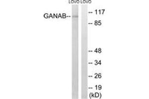 Western blot analysis of extracts from LOVO cells, using GANAB Antibody. (GANAB 抗体  (AA 242-291))